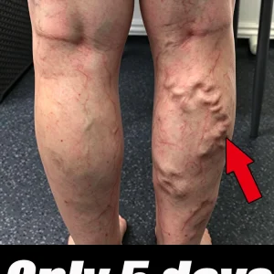 Protect your legs, promote blood circulation