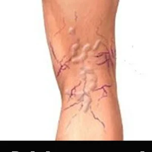 Body care for feet, legs, thighs